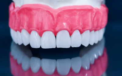 The Four Types Of Dental  Implant Restorations