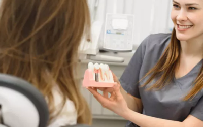 What Is The Recovery Time For Dental Implants?